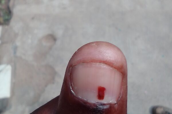 Soweto Ward 130 by-elections.