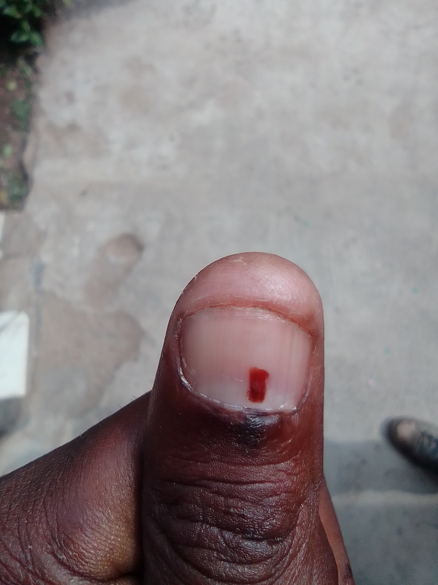 Soweto Ward 130 by-elections.